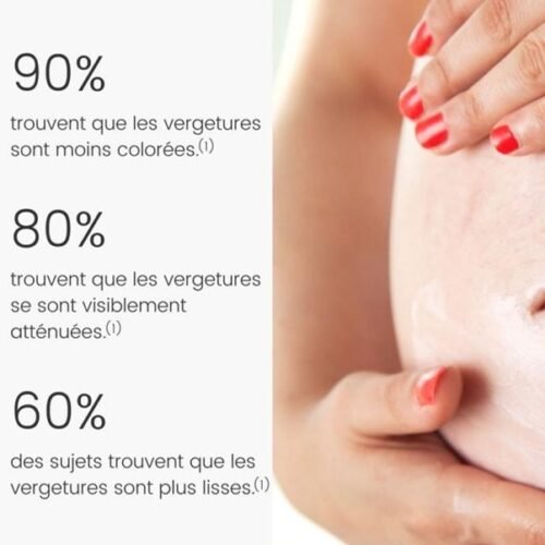 SOS Stretch Marks Balm - 100% MOM - 3 SOS Stretch Marks Balm - 100% MOM (100 ml)