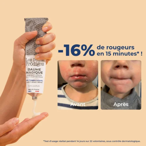 BaumeMagique-_2_3000x Le Baume Magique en Tube - Balsam (120 ml)