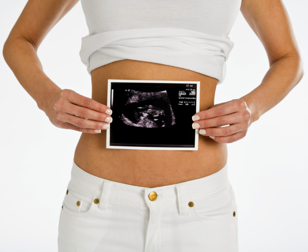 woman holding sonogram 1922245 Photo by Creatas Images on FreeImages